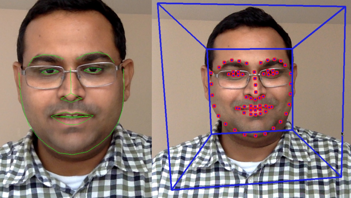 Cushingoid facial features