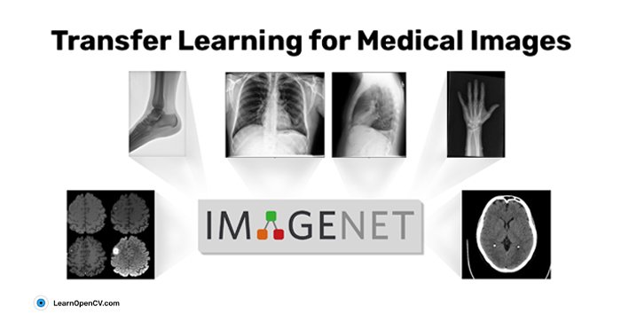 Transfer Learning for Medical Images