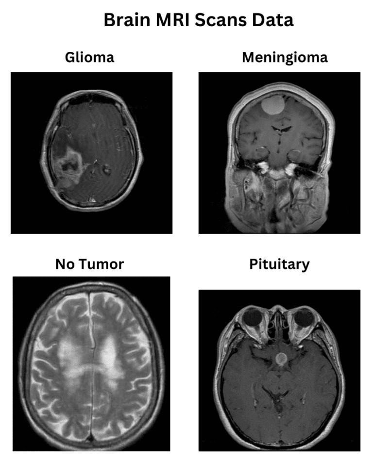 GradCAM Enhancing Neural Network Interpretability