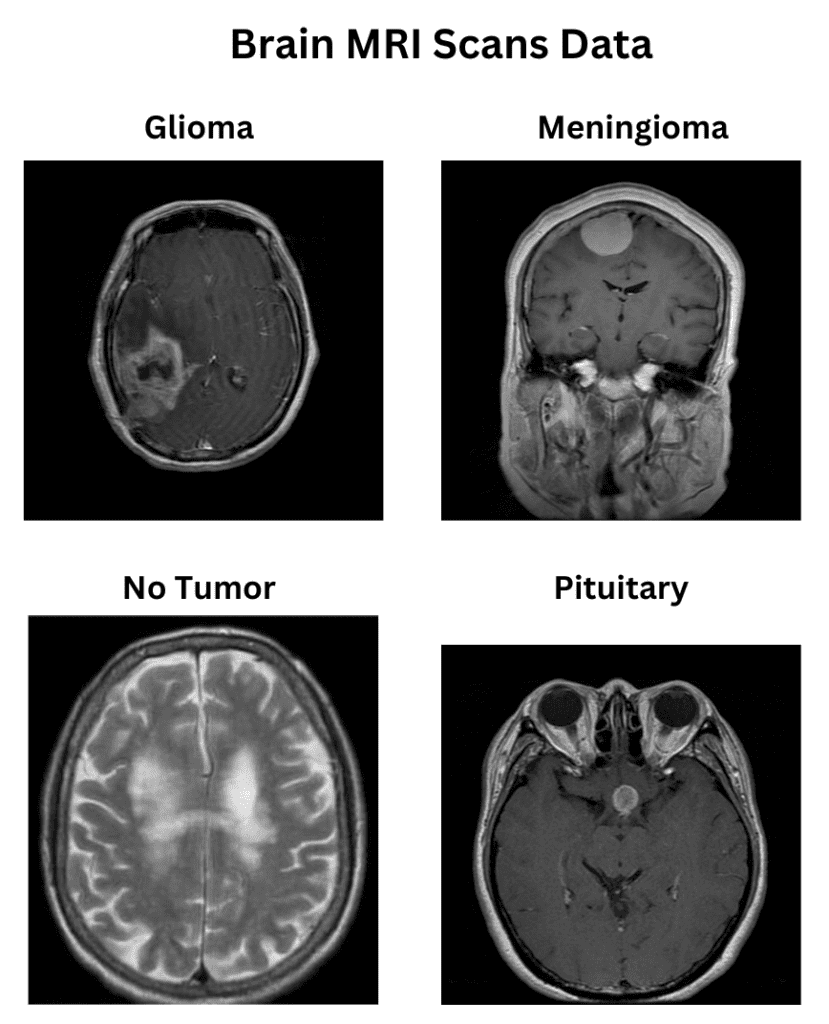 Brain MRI Scans Dataset for computing GradCAM