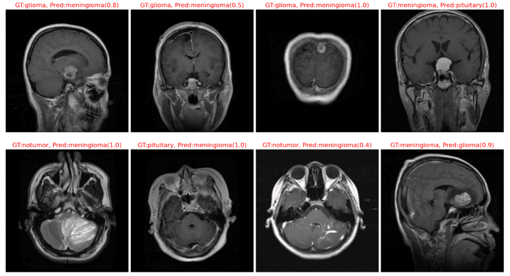 EfficientNetV2 small misclassifications on Brain MRI Data