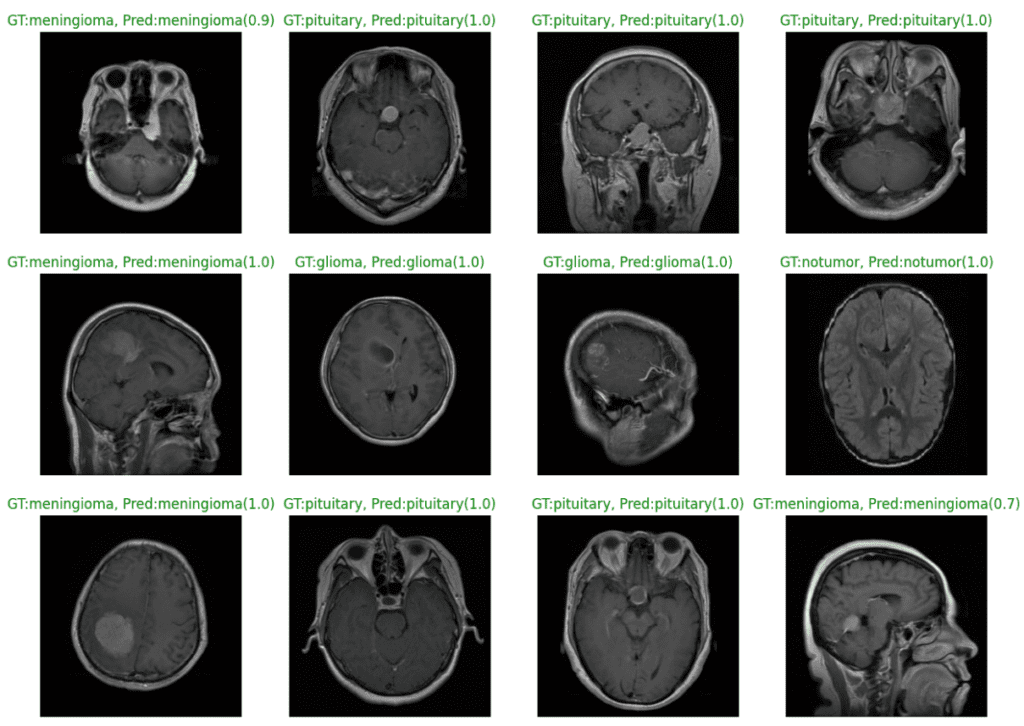 EfficientNetV2 small predictions on Brain MRI data