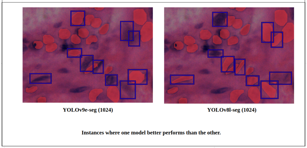 yolov9 instance segmentation -Quantitative detection difference between YOLOv9e-seg v/s YOLOv8l-seg