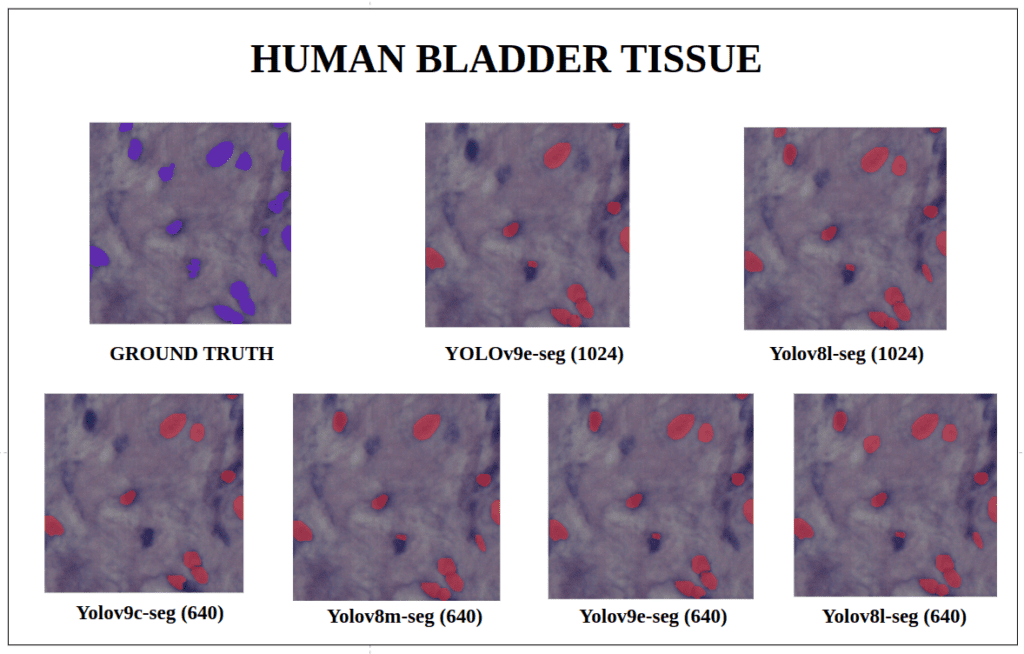 yolov9 instance segmentation -Human Bladder Tissue YOLOv9-seg v/s YOLOv8-seg Instance Segmentation