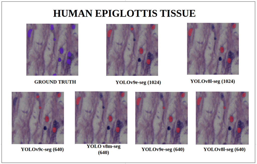 yolov9 instance segmentation -Human Epiglottis Tissue -  YOLOv9-seg v/s YOLOv8-seg Instance Segmentation