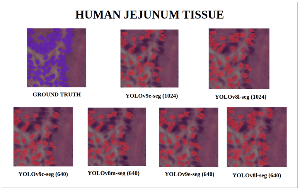 yolov9 instance segmentation - Human Jejunum Tissue - YOLOv9-seg v/s YOLOv8-seg Instance Segmentation