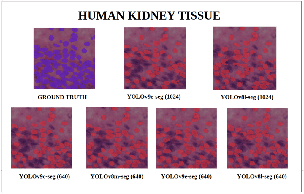 yolov9 instance segmentation - Human Kidney Tissue - YOLOv9-seg v/s YOLOv8-seg Instance Segmentation 