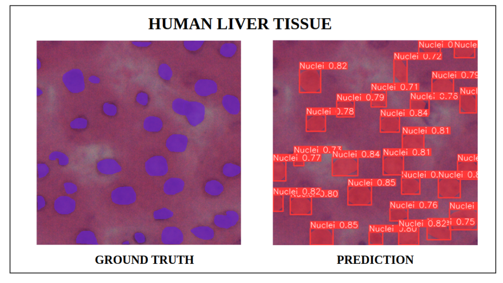 yolov9 instance segmentation -YOLOv9e-seg Inference on Human liver Tissue