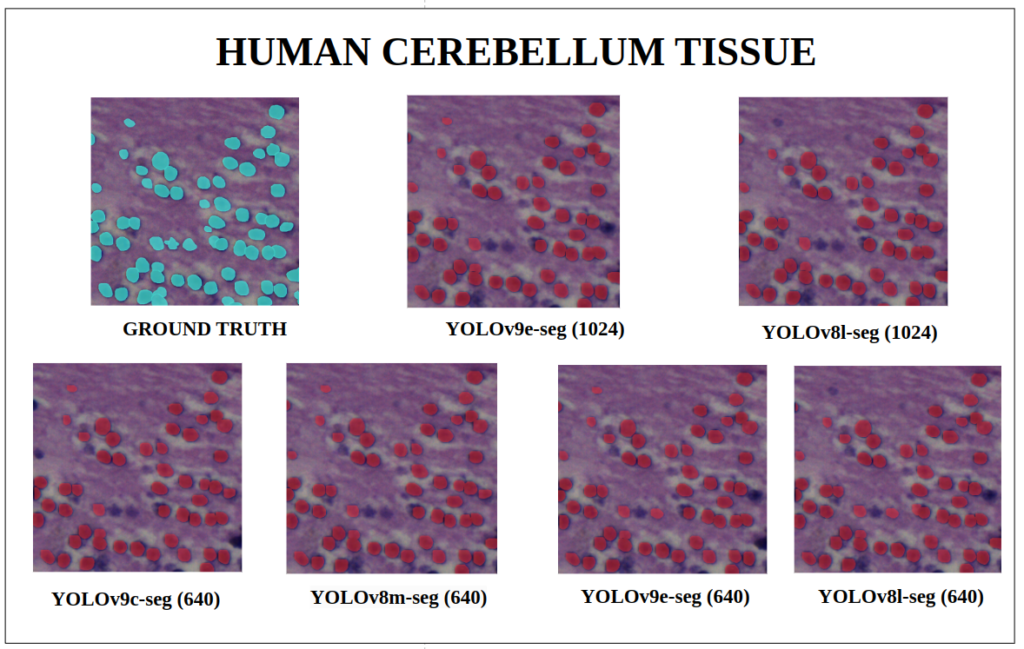 yolov9 instance segmentation -Human Cerebellum Tissue - YOLOv9-seg v/s YOLOv8-seg Instance Segmentation 
