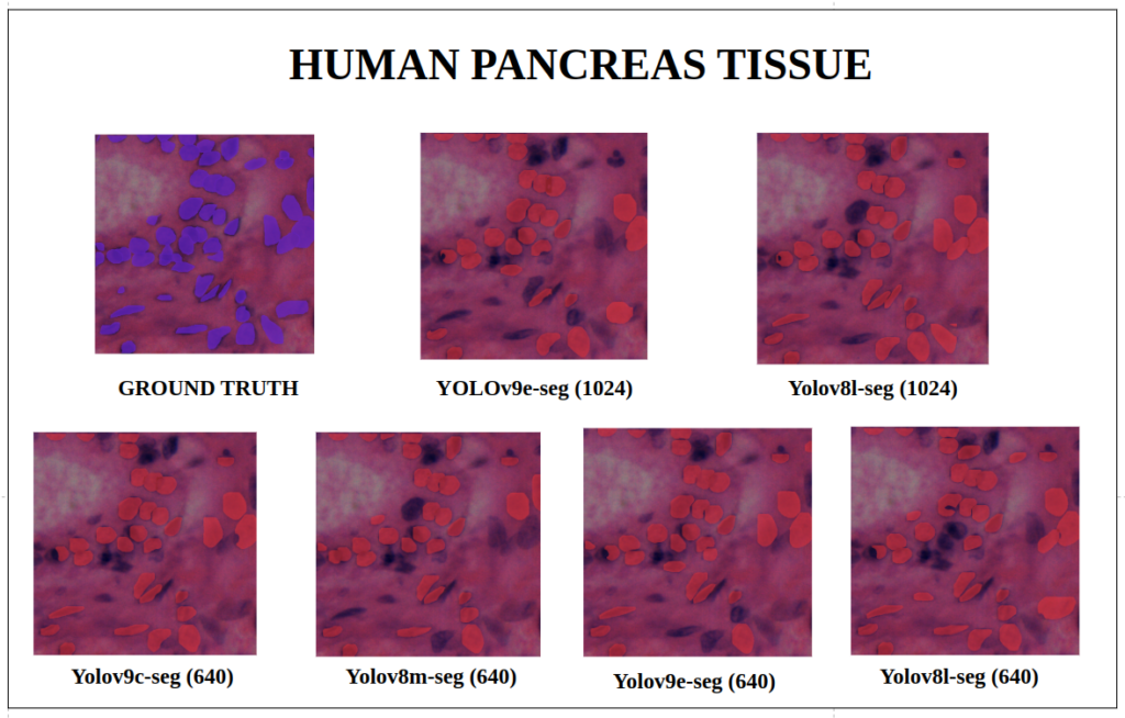 yolov9 instance segmentation - Human Pancreas Tissue - YOLOv9-seg v/s YOLOv8-seg Instance Segmentation
