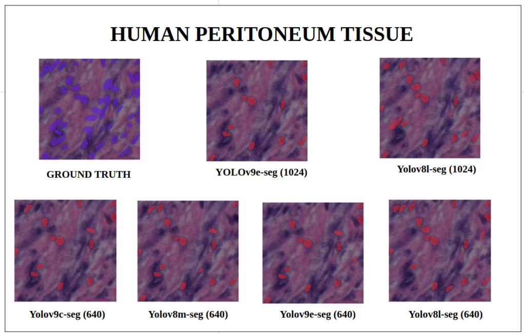 yolov9 instance segmentation -Human Peritoneum Tissue YOLOv9-seg v/s YOLOv8-seg Instance Segmentation