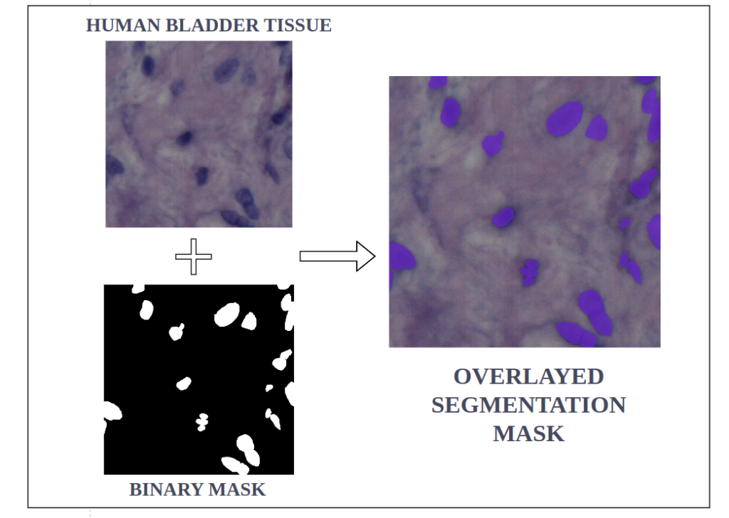 yolov9 instance segmentation -Nuclei Instance Segmentation Dataset: classes: Nuclei