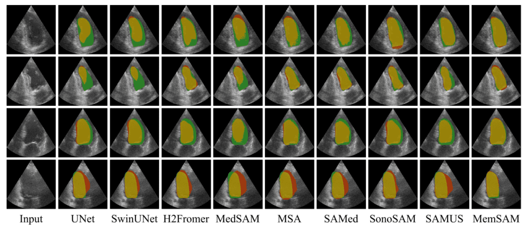 Comparison with SOTA Medical Segmentation Models - MemSAM: Taming Segment Anything Model for Echocardiography Video Segmentation - CVPR best papers 2024