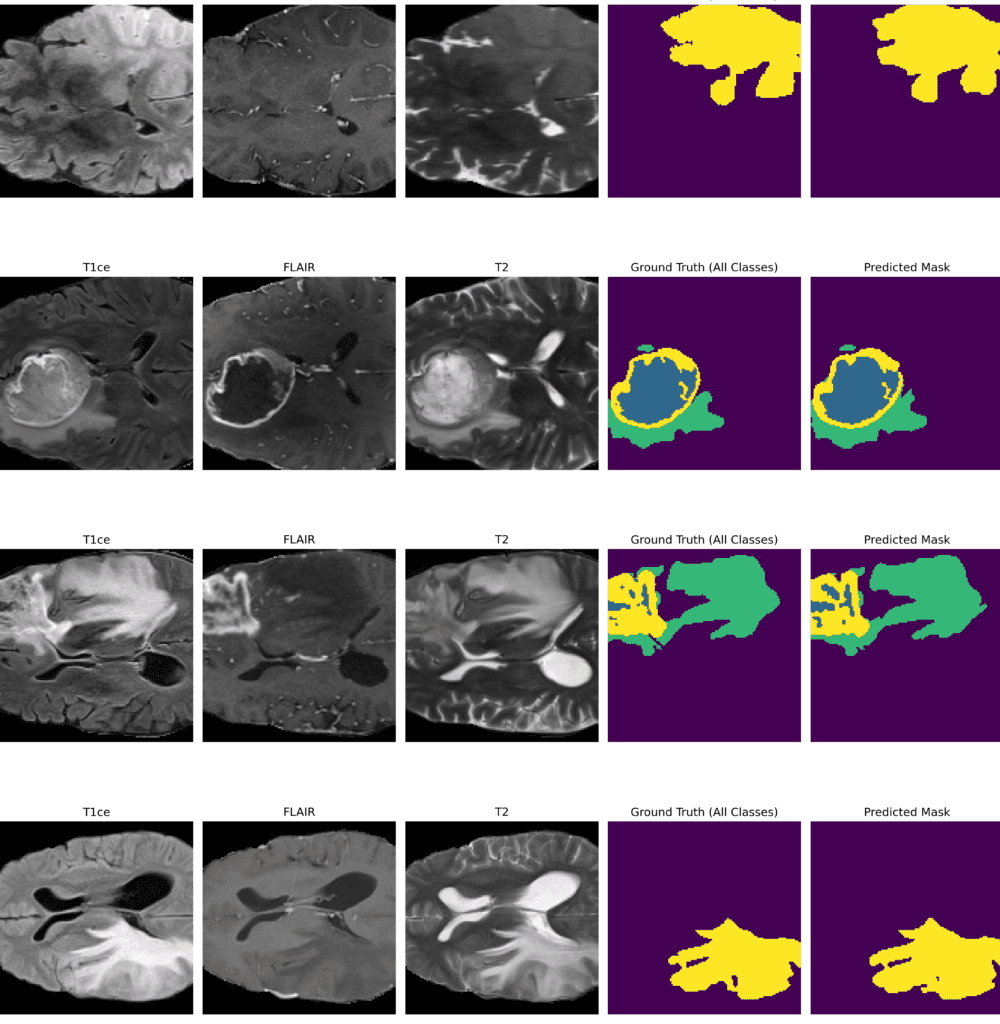 Inference Results of Trained 3D U-Net - Brain tumor detection using 3D convolution- Why use 3D imaging techniques for brain tumors?