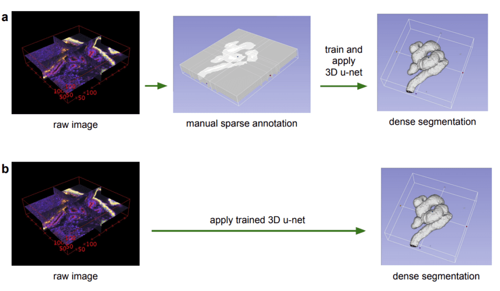 Saprse-Annotations-What are the advantages of 3D convolution over 2D?
- Learning Dense Volumetric Segmentation from Sparse Annotation